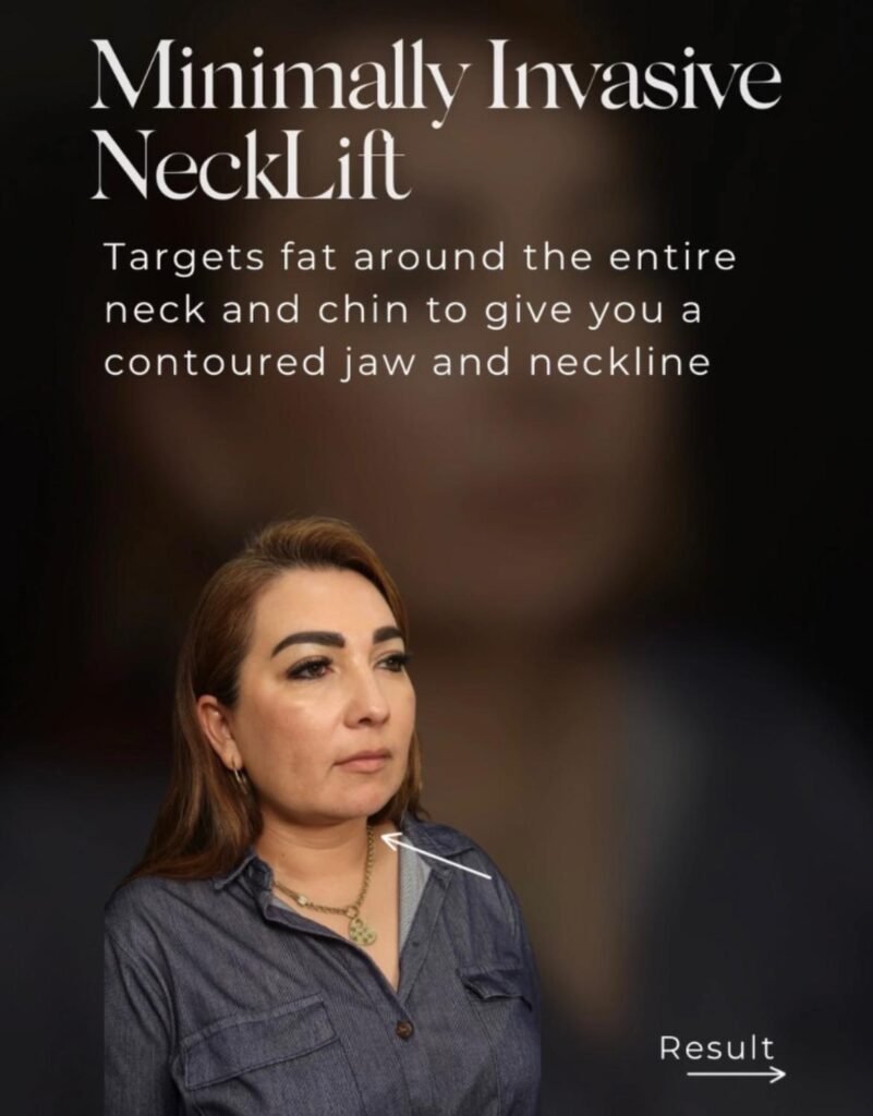 Skinfirm Neck lift