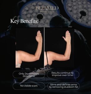 Awake Skinfirm Arm lift