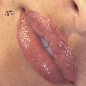 Sonrojo en los labios después